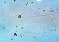 Brote-de-ciclosporiasis | La Silla Regia Field of Many Small Circular Cells with Dark Centers Seen Under a Light Microscope on a Pale Blue Background. | La Silla Regia