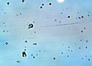 Field of Many Small Circular Cells with Dark Centers Seen Under a Light Microscope on a Pale Blue Background. | La Silla Regia