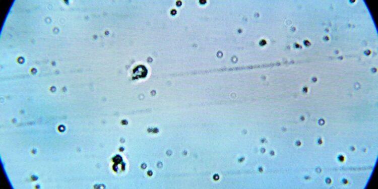 Brote-de-ciclosporiasis | La Silla Regia Field of Many Small Circular Cells with Dark Centers Seen Under a Light Microscope on a Pale Blue Background. | La Silla Regia